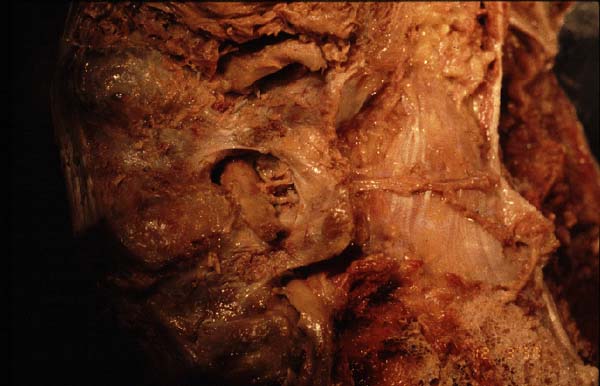 dorsal ramus