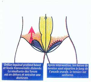 SOFMMOO - La Société Française de Médecine Manuelle - The French ...