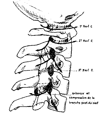 Articulaires postérieures cervicales